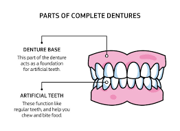 full dentures