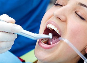 invisalign , implants , bridges , crowns trinidad dentist